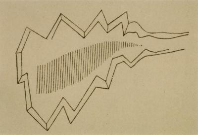 Jean-Martin Charcot, scintillating scotoma, 1888