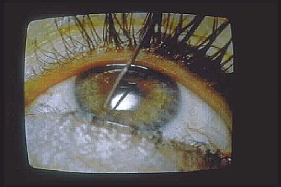 Marina-Abramovic-In-Between