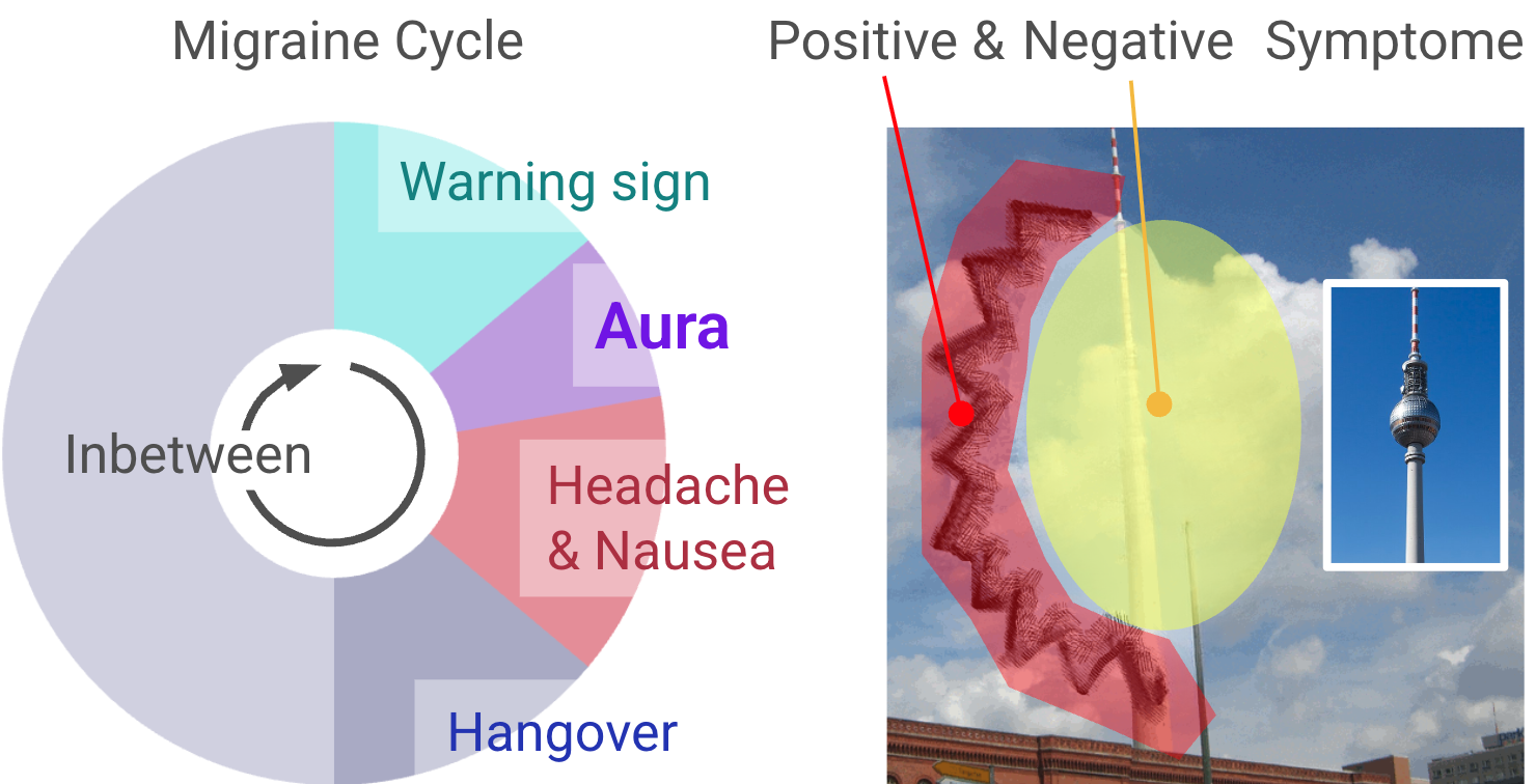 The same aura annotated with clinical diagnostic criteria.