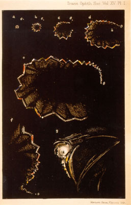 H. Airy’s illustration of the fortification spectrum (reproduced from Gowers, 1895) — one of the earliest accurate depictions of the visual migraine aura.